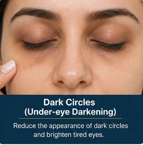 Under-eye dark circles before brightening treatment