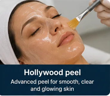 Hollywood peel being applied for smooth, glowing skin