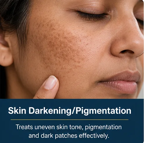 Uneven skin darkening and pigmentation on the face before treatment