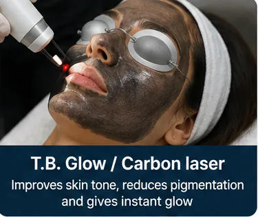 T.B. glow carbon laser facial being performed for an even skin tone