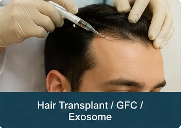 Hair transplant procedure using GFC and Exosome therapy at the hairline