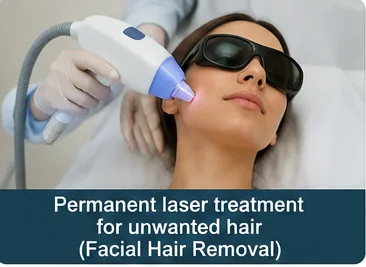 Permanent laser treatment for unwanted facial hair