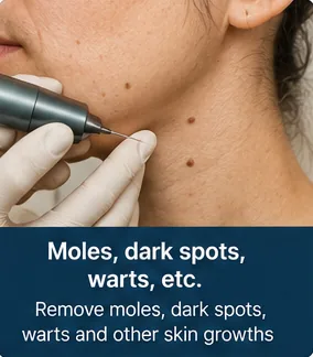 Moles and dark spots on the neck before removal treatment