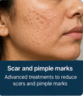 Scars and pimple marks on the cheek before treatment