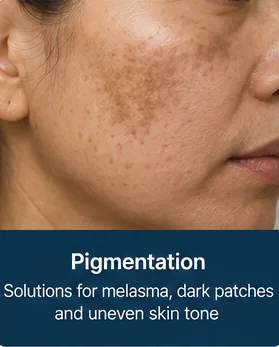 Uneven skin tone and pigmentation on the cheek before treatment